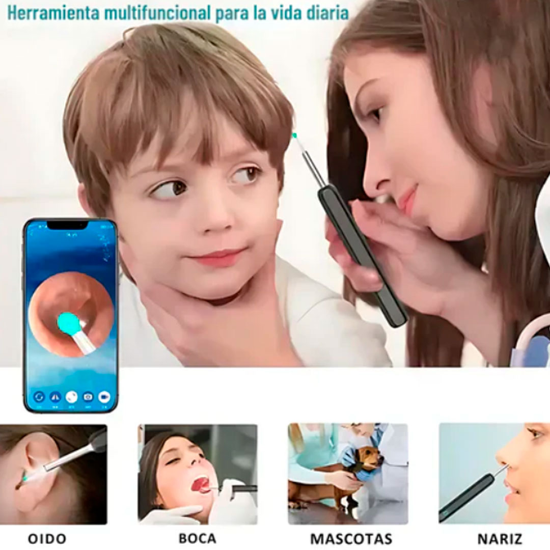 EarView™ – Limpia tus oídos con precisión HD y sin riesgos
