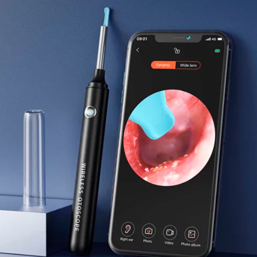 EarView™ – Limpia tus oídos con precisión HD y sin riesgos