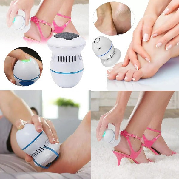 Removedor de Callos - SmoothCare 👣🪄